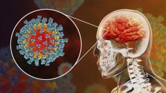 وجود تلف بالأوعية الدموية.. دراسة حديثة تكشف تأثير فيروس “كورونا” على الدماغ