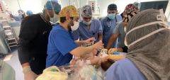 استشارية : التوأم السيامي العراقي خضع لجراحة تجميل قبل عملية الفصل