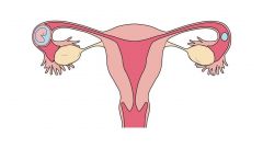 الحمل خارج الرحم.. أسبابه وأعراضه ومضاعفاته وطرق التشخيص والعلاج