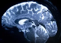 صورة “رنين” تُبدد ألغاز الدماغ البشري