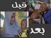 شفاء “منهاج” يعيد الأمل لأطفال الصومال”صور”