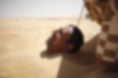 تحذير طبي من “حمَّام الرمل”.. مضاعفاته قد تسبب الوفاة ولا دليل علميًّا على فوائده