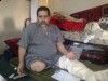 حادث مروري وعمليات جراحية خاطئة تفقد عامل مصري ساقه وذراعه وكفه