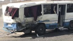 بالصور.. إصابة 30 طالبة جامعية إثر انقلاب حافلة في بيشة