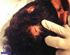 بالصور.. طالب ثانوي يطعن معلماً ويصيبه بجروح غائرة بعد أن حرر له محضر غشّ
