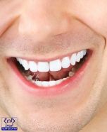 8 نصائح للحصول على أسنان بيضاء مثل اللؤلؤ
