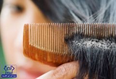 وصفة فعالة للتخلص من القشرة واستعادة نمو الشعر
