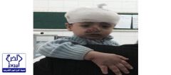 العثور على مفقود كلاخ الطفل “إياد” مُصاباً برأسه ومحتجز داخل مسجد بالطائف