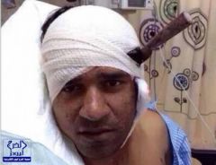 مكة: الشرطة تكشف ملابسات حادثة طعن شاب بسكين في رأسه