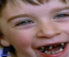 6 نصائح مهمة لحماية طفلك من تسوس الأسنان