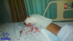 سعودي يتهم إيرانية ببتر وكسر إصبعيه وإصابته برباط صليبي في مكة