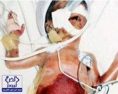 الناصري يتهم مستشفى خاصا بالتسبب في وفاة طفله بتسمم الدم
