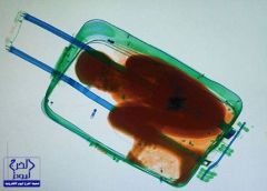 مغربية تخبئ طفلاً بحقيبة سفر والأشعة تكشفه