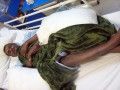 بمستشفى الخالدية بالخرج : هندي معاق لا يستطيع الحركة منذ سنوات ومطالب بدفع 219 ألف ريال