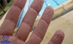 هذا هو سبب تجعد جلد أصابعنا في الماء!