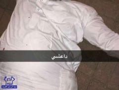 الاعتداء على مواطن عشريني في القطيف بدعوى انتمائه لداعش