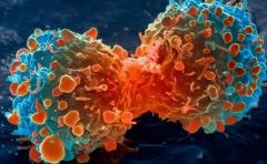 دراسة: 90% من حالات الوفاة بالسرطان سببها “نقيلات” ناشئة من الورم الأصلي