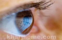 طبيب عيون: فيتامين «B3» يمنع الإصابة بالمياه الزرقاء