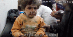 بالفيديو.. مقطع مؤثر لطفلة مصابة من حلب في حالة ذهول وتكتم بكاءها رغم ألمها